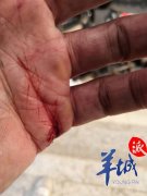 广州市民被外卖电动车撞倒多处受伤 骑