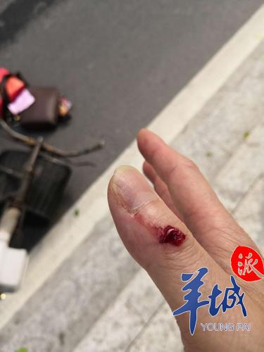 广州市民被外卖电动车撞倒多处受伤 骑手匆匆离开