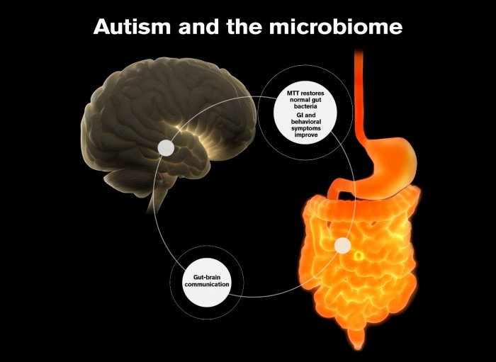 研究称粪便菌群移植大幅缓解了儿童的自闭症症