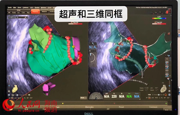 為使用特許進口器械北京患者遠赴博鰲超級醫院手術