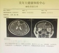 定期体检不走过场,美年大健康让癌症